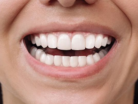 قبل علاج المقومات الشفافة في عيادة عادل للأسنان